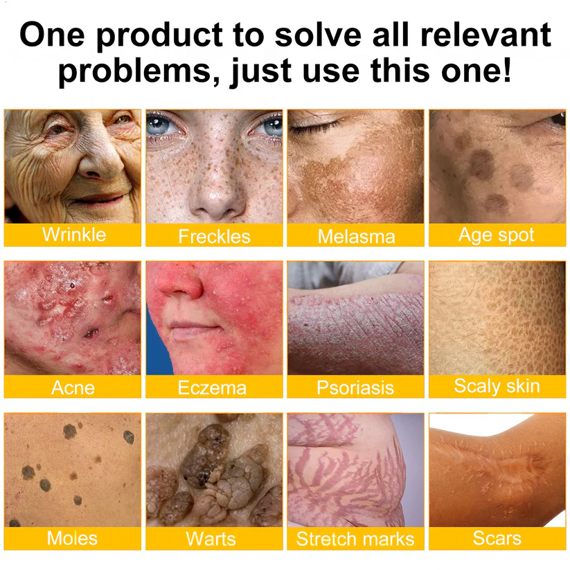 Genieße 30 % Rabatt beim Hinzufügen des zweiten Artikels 🧡