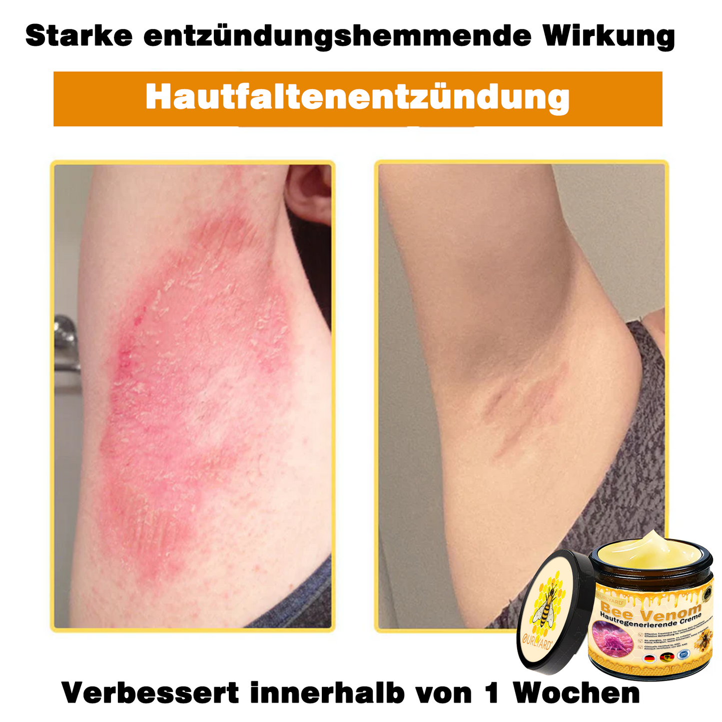 Genieße 30 % Rabatt beim Hinzufügen des zweiten Artikels 🧡